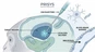 Servicios de inyección intracerebral (ICM) del NHP|Prisys Biotecnología