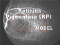 Modelo NHP de retinitis pigmentosa (RP)